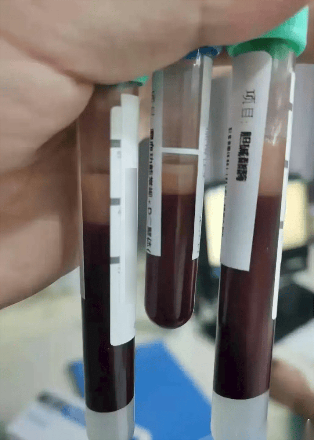 科尔多瓦vs卡斯迪隆_一口气干掉5只科尔多瓦vs卡斯迪隆，宁波男子被连夜送急诊！正大量上市！医生提醒：一次别超过2只