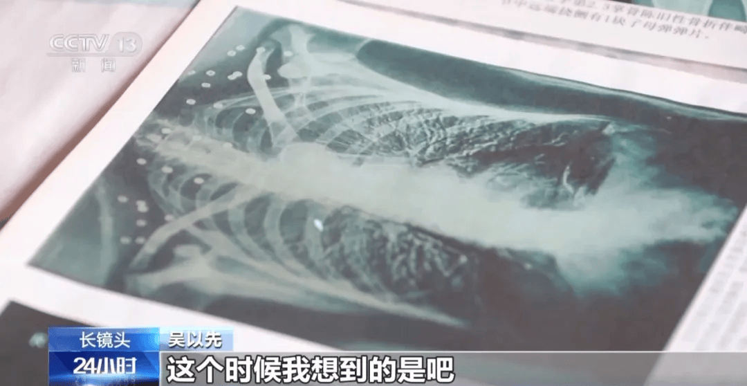 皇冠信用盘可以占几成
_“老先生皇冠信用盘可以占几成
,您把项链取下来再做CT”