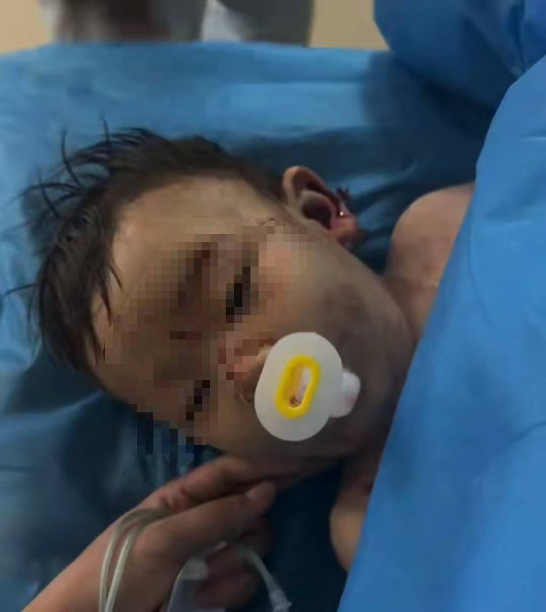 Hga030app_充气滑梯倾倒10人受伤Hga030app,包头2岁男童“睁眼性昏迷”已2个多月,当地披露事故原因