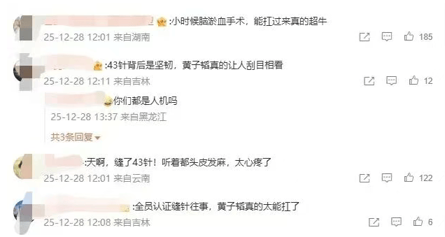 正版皇冠信用网代理_冲上热搜!黄子韬因脑淤血接受开颅手术缝了43针正版皇冠信用网代理,本人回应