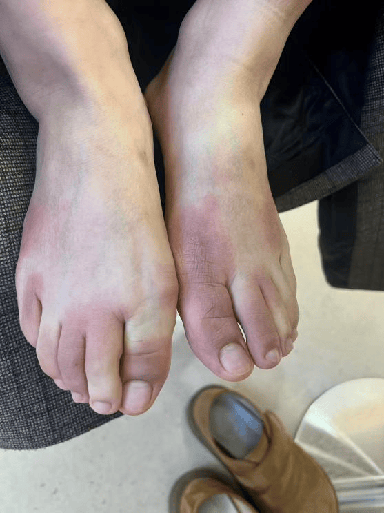 皇冠登录网址
_东北姑娘来浙江后崩溃了皇冠登录网址
,穿3条加绒裤还冻到发抖!南方人冬天怎么保命,网友吵翻!